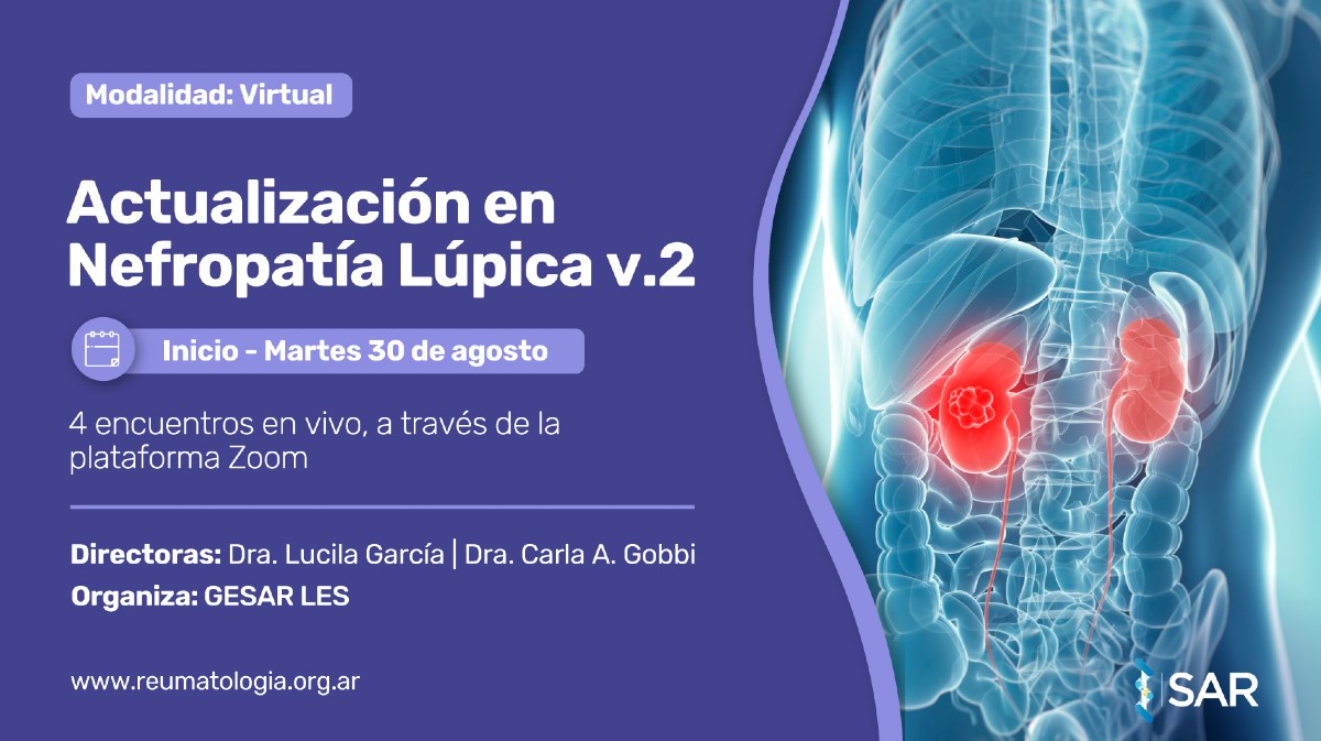 Actualización en Nefropatía Lúpica v.2